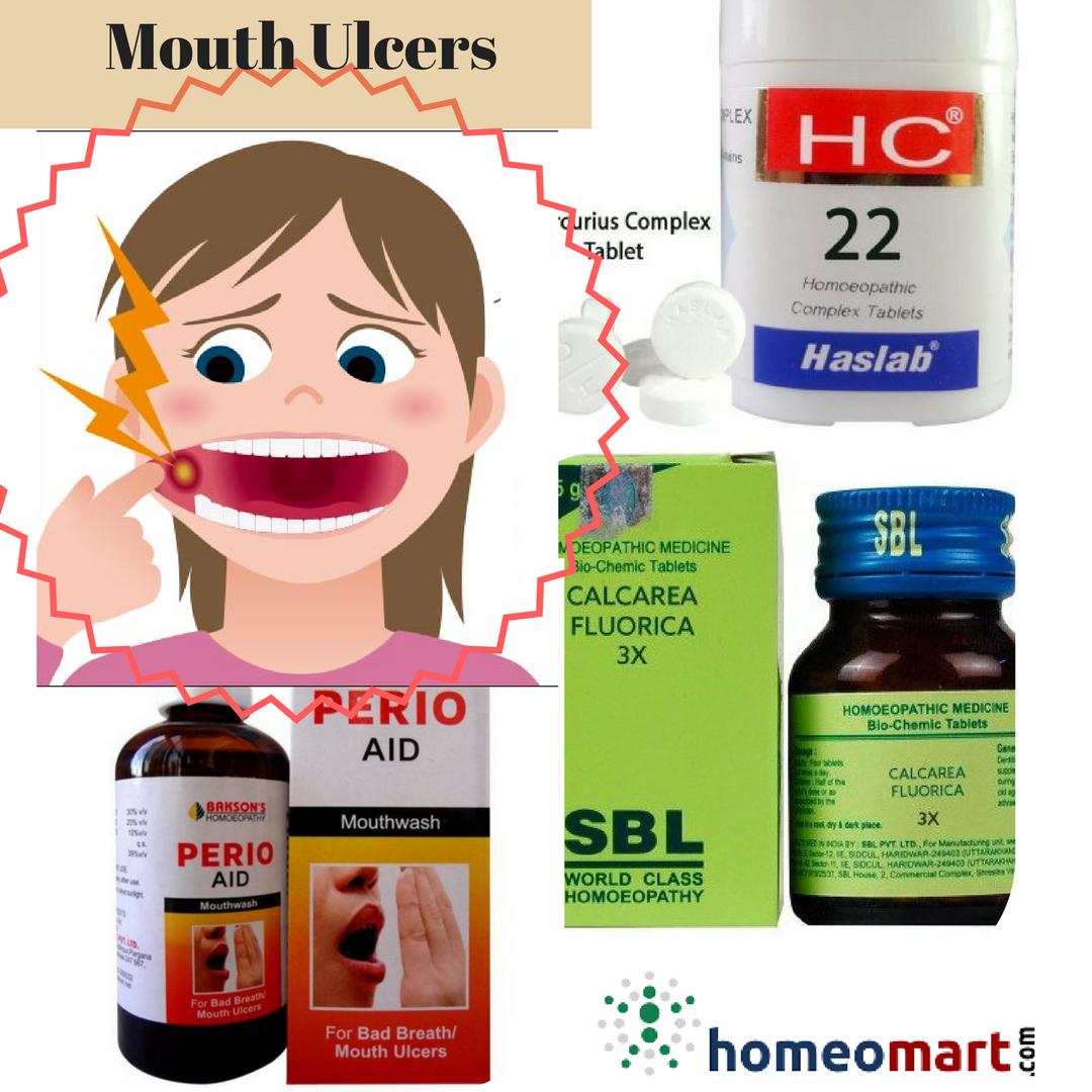 Buy Omeo Mouth Ulcer Tablets, Treats painful gum boils with Borax ...